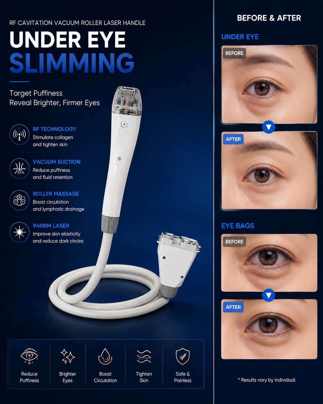 Under Eye Handle