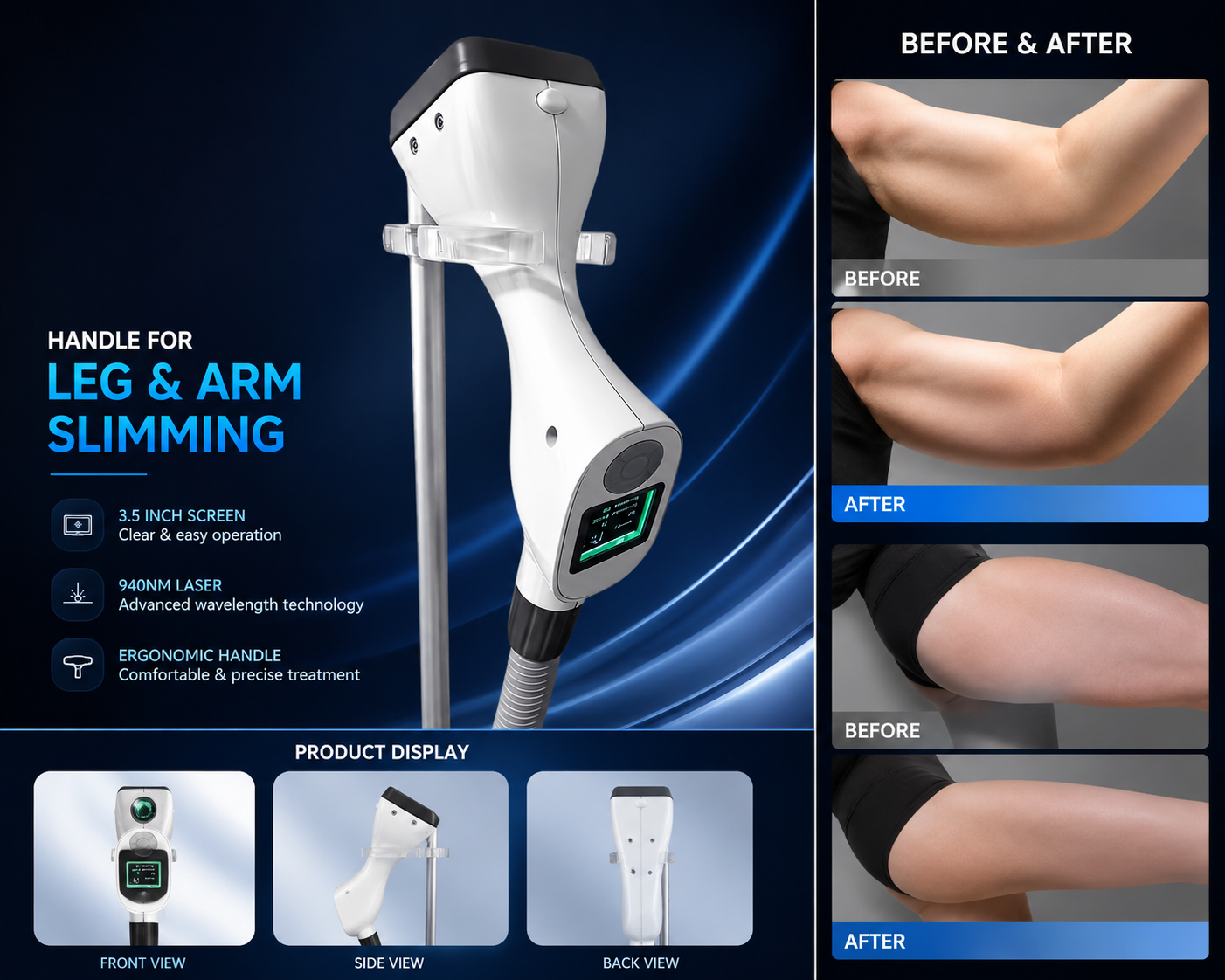 Leg and Arm Handle