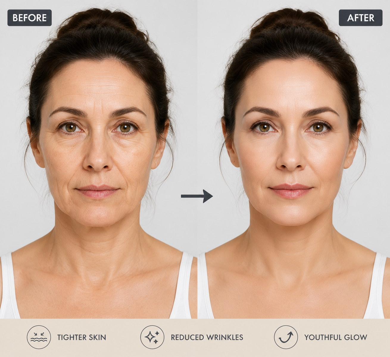 Skin Tightening & Rejuvenation
