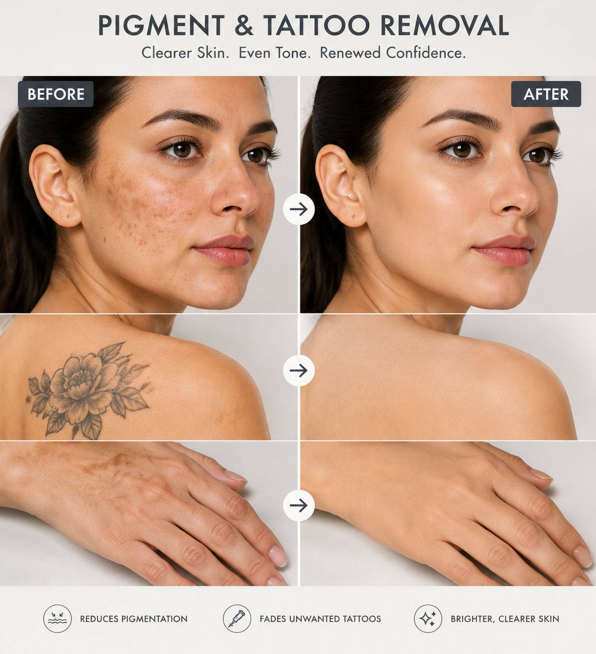Pigment, Tattoo & Acne Scar Removal